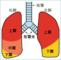 大腸がん手術後の肺転移