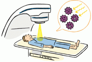 がん治療で手術と放射線治療を併用する効果について