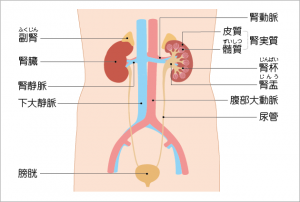 腎臓がんの種類（タイプ）とステージ